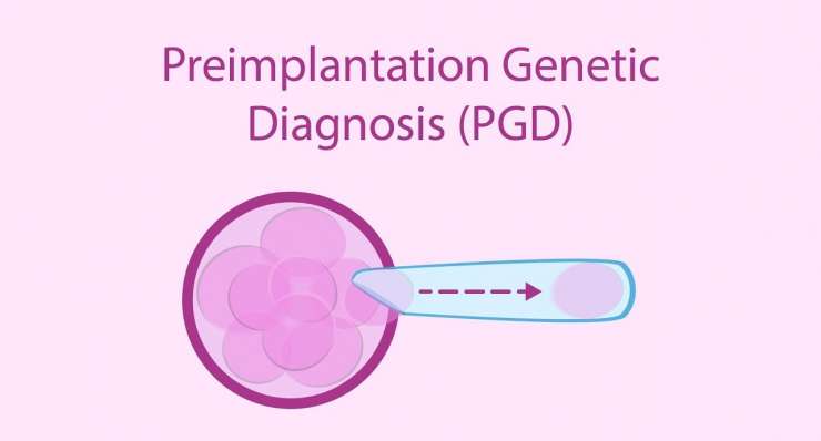 (PGT) الخارطة الوراثية قبل الزراعة