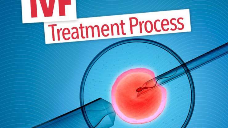 لمن يُنصح بعلاج أطفال الأنابيب؟ دليل خطوة بخطوة
