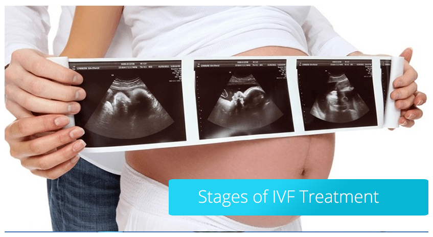 Stages of IVF Treatment