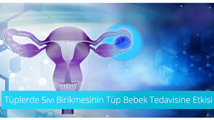 The Effect of Fluid Accumulation in Tubes on IVF Treatment
