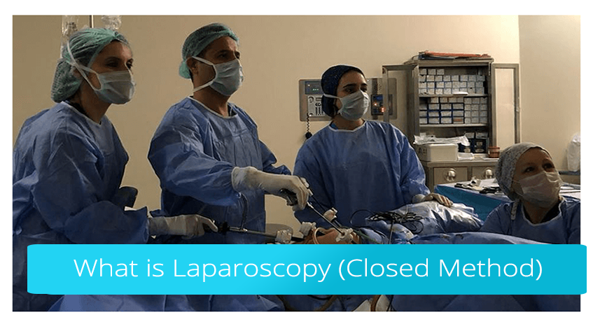 What is Laparoscopy (Closed Method)?