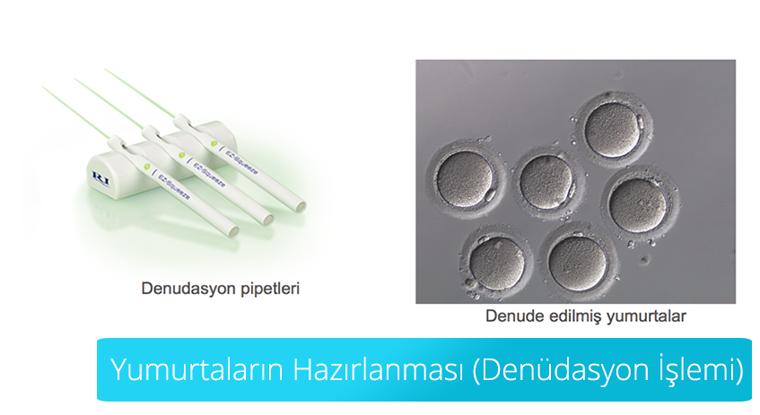 DENUDATION (EGG PREPARATION)