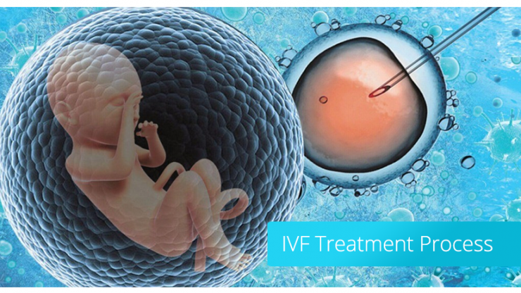 IVF Treatment Process