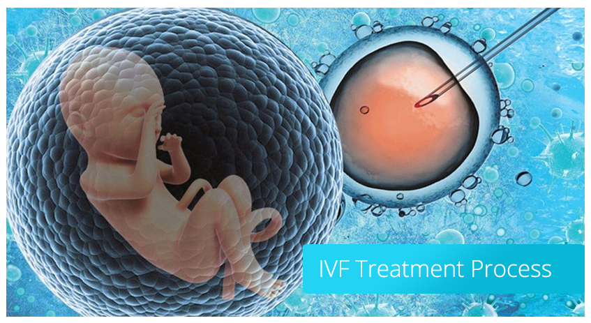 IVF Treatment Process