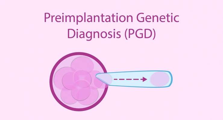 Präimplantationsdiagnostik (PID)