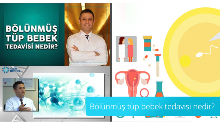 Was ist die geteilte IVF-Behandlung?