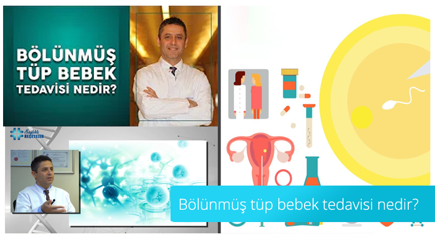 Was ist die geteilte IVF-Behandlung?