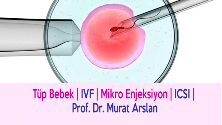 IVF (ICSI): Wie läuft die Behandlung ab?