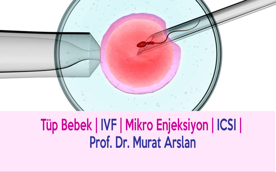 IVF (ICSI): Wie läuft die Behandlung ab?