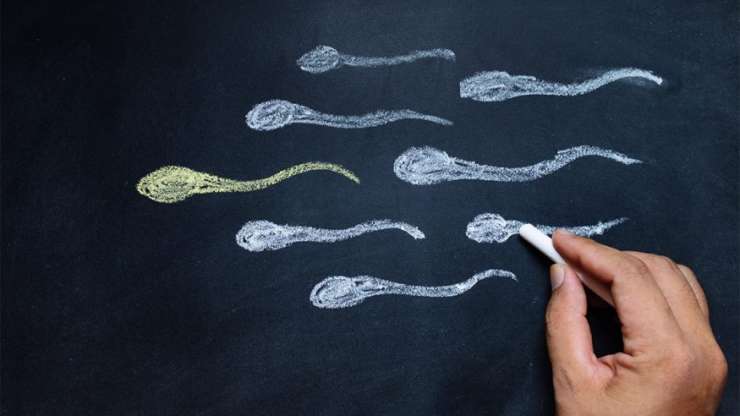 Das Spermiogramm (Samenanalyse): Was ist das und wie wird es ausgewertet?