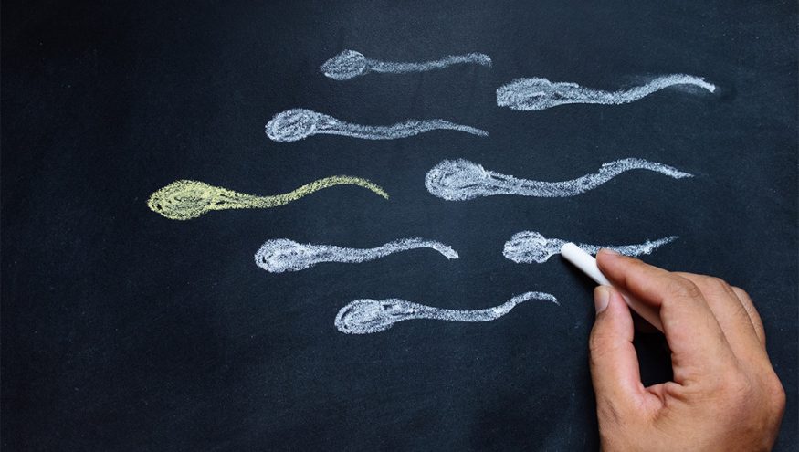Das Spermiogramm (Samenanalyse): Was ist das und wie wird es ausgewertet?