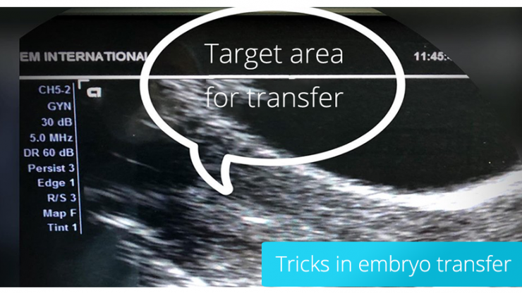 Tipps zum Umgang mit Embryonen in der IVF