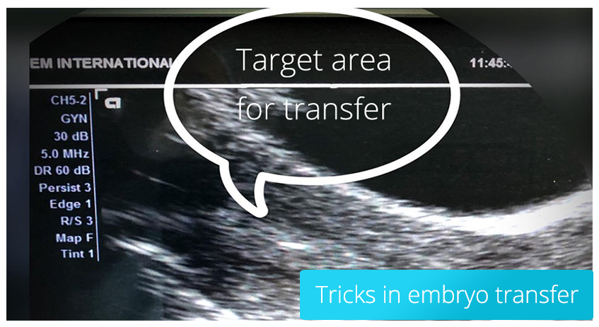 Tipps zum Umgang mit Embryonen in der IVF