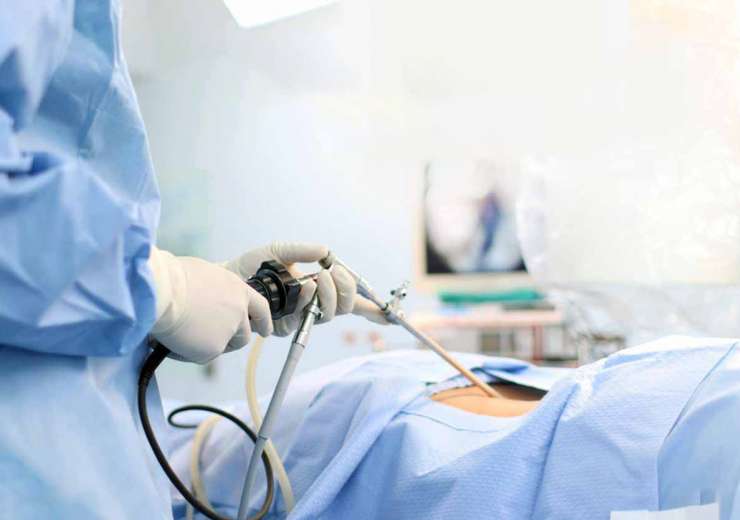 ENDOSCOPIC SURGERY