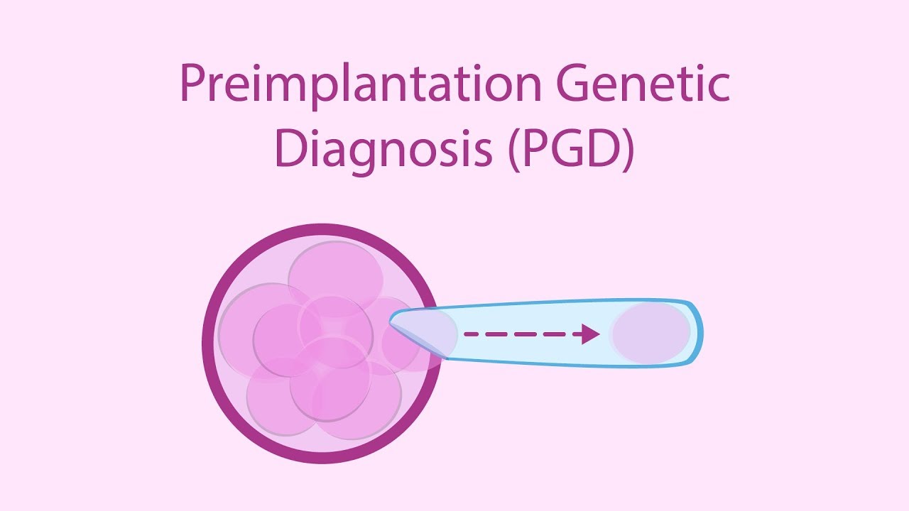 preimplantation genetic diagnosis