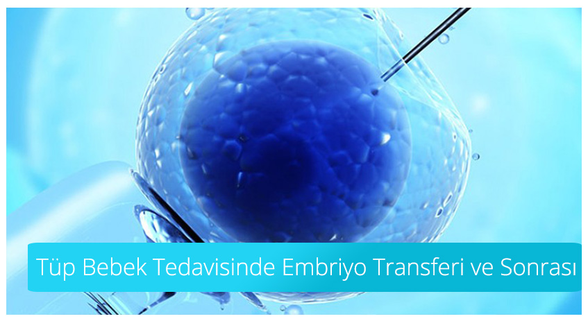 Embryo Transfer in IVF Treatment and After