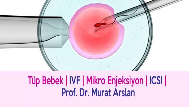 IVF (ICSI) How is it done?