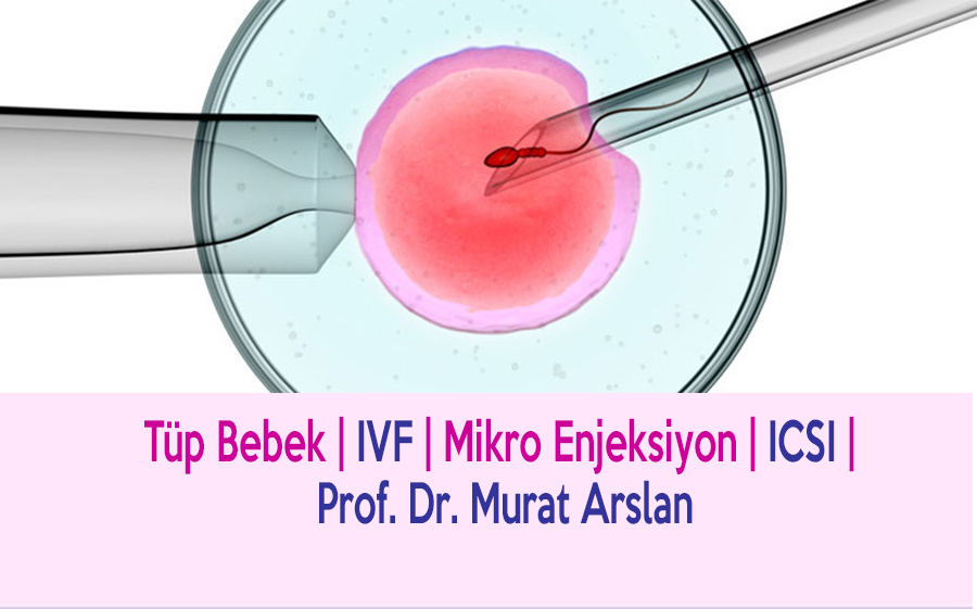 IVF (ICSI) How is it done?