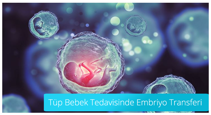 Tüp Bebek Tedavisinde Embriyo transfer İşlemi