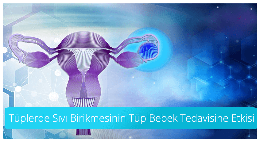 Tüplerde Sıvı Birikmesinin Tüp Bebek Tedavisine Etkisi