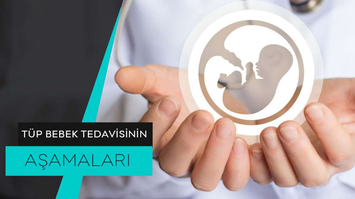 Tüp Bebek Tedavisi Centre de FIV d�Istanbul