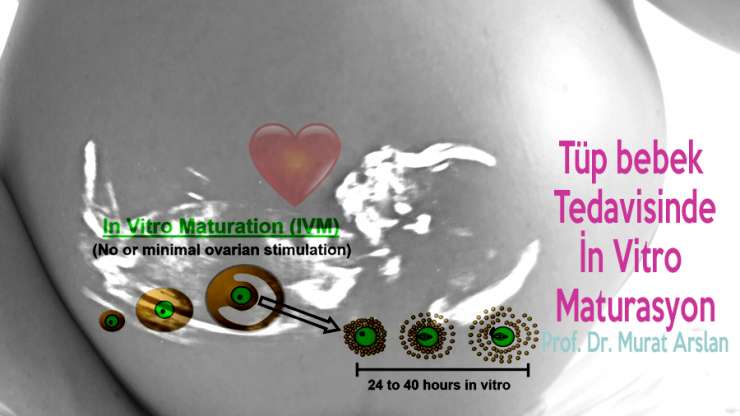 Созревание in vitro в лечении ЭКО