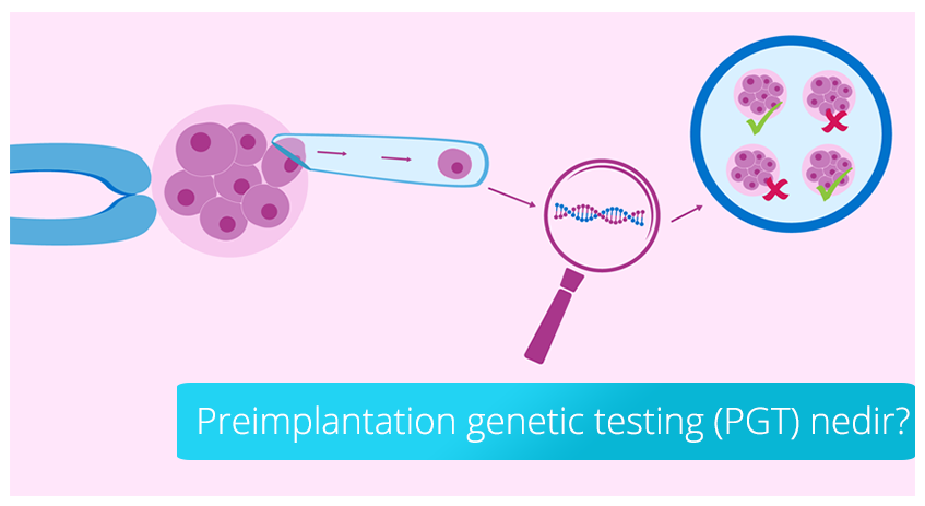 Что такое преимплантационное генетическое тестирование (ПГД)?