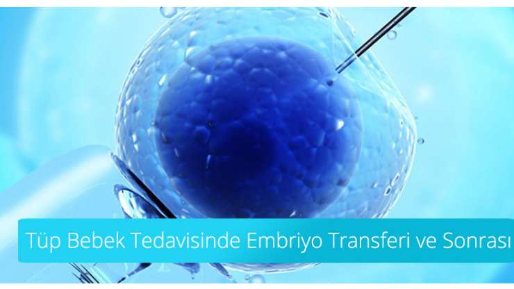 Tüp Bebek Tedavisinde Embriyo Transferi ve Sonrası