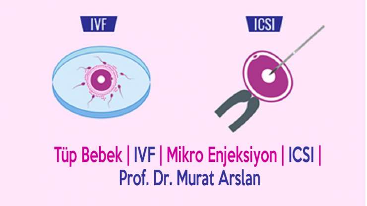 Tüp Bebek (IVF) (ICSI) Nasıl Yapılır?