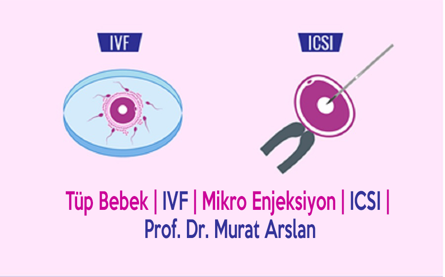 Tüp Bebek | IVF | Mikro Enjeksiyon | ICSI | Prof.Dr.Murat Arslan | Tüp Bebek Üstün Teknoloji ve Uzman Kadro - Tüp Bebek (IVF) (ICSI) Nasıl Yapılır?