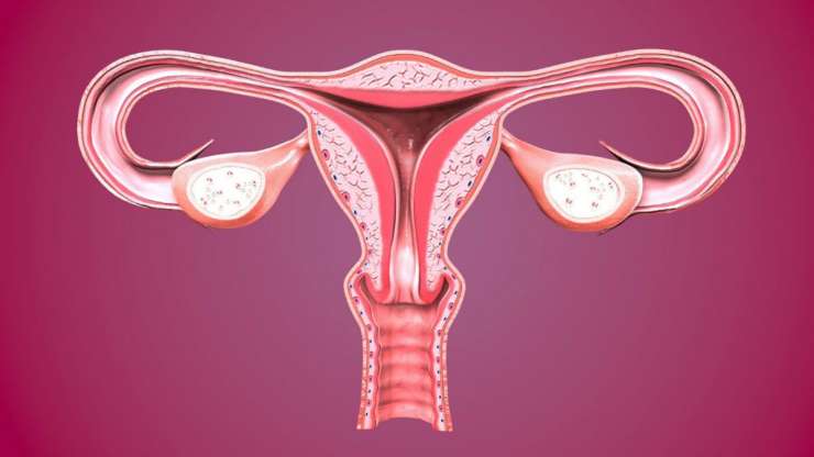 İnfertilite Kısırlık Kadında Rahim ağzına ait problemler