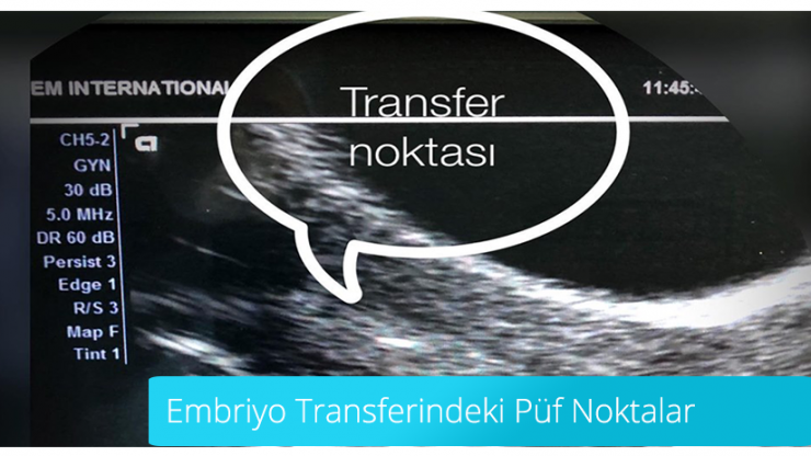 Embriyo Transferindeki Püf Noktalar