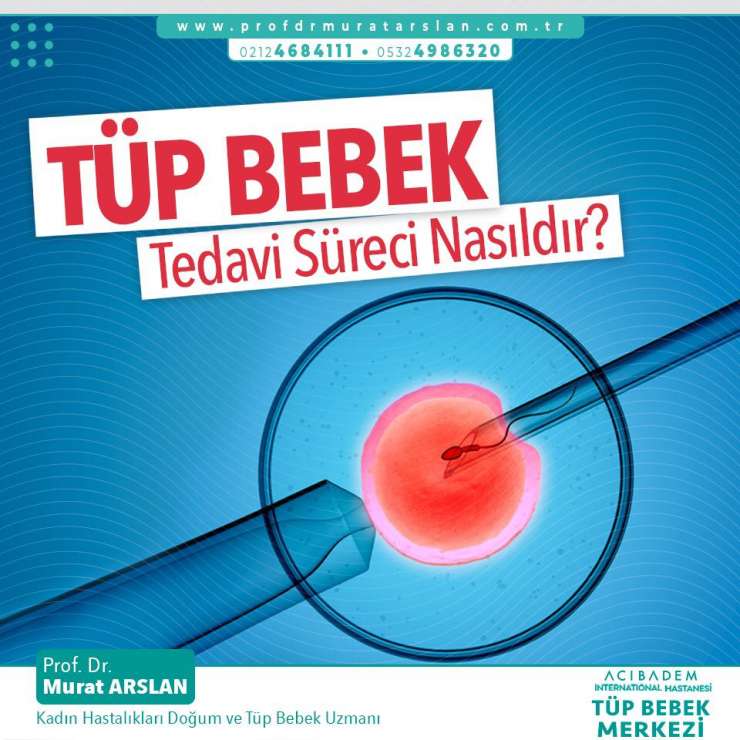 Tüp Bebek Tedavisi Nedir, Tüp Bebek Tedavi Süreci Nasıldır