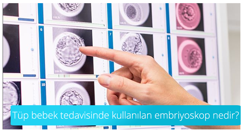 Tüp bebek tedavisinde kullanılan embriyoskop nedir?